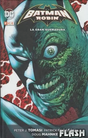 BATMAN Y ROBIN : LA GRAN QUEMADURA