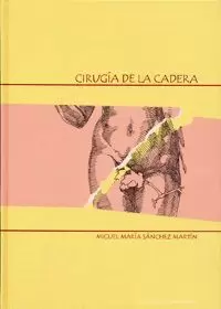 CIRUGIA DE LA CADERA.
